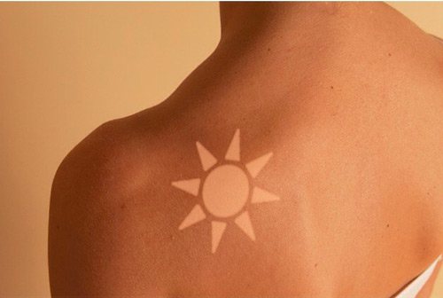 Sunny “tattoo”